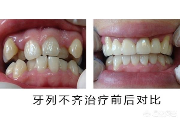 红河最新24小时牙医在线咨询方法分析(最方便真实的红河有没有24小时牙医方法)